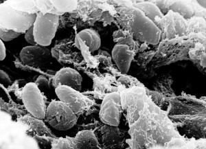 Yersinia_pestis [Public Domain, credit: NIH]