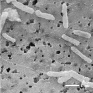 Enterobacter W1 [CC-BY-SA-3.0 Steve Cook]; cylindrical cells about a micron long