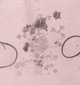 Vorticella micrograph [CC-BY-SA-3.0 Steve Cook]